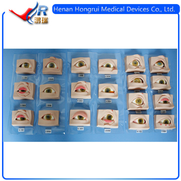 High Quality Human Oculopathy Anatomical Model, Medical Eye Models, Eye Disease Model