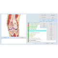 Vektordiagnose nls Scan-Maschine