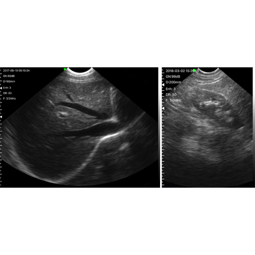 UPROBE-C5M SONOSTAR Tragbare Ultraschallmaschine