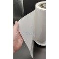 0.4mm PP vacuum blister food packaging cold resistance