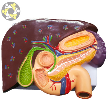 Science-Based Medical Teaching Model: Liver Pathology with Duodenum and Stomach