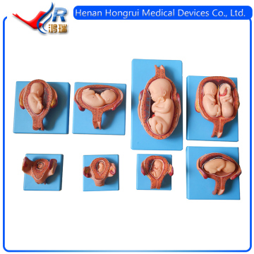 Development Process Of Anatomical Fetal Pregnancy Model
