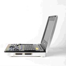 Female gallstones ultrasound diagnosis instrument