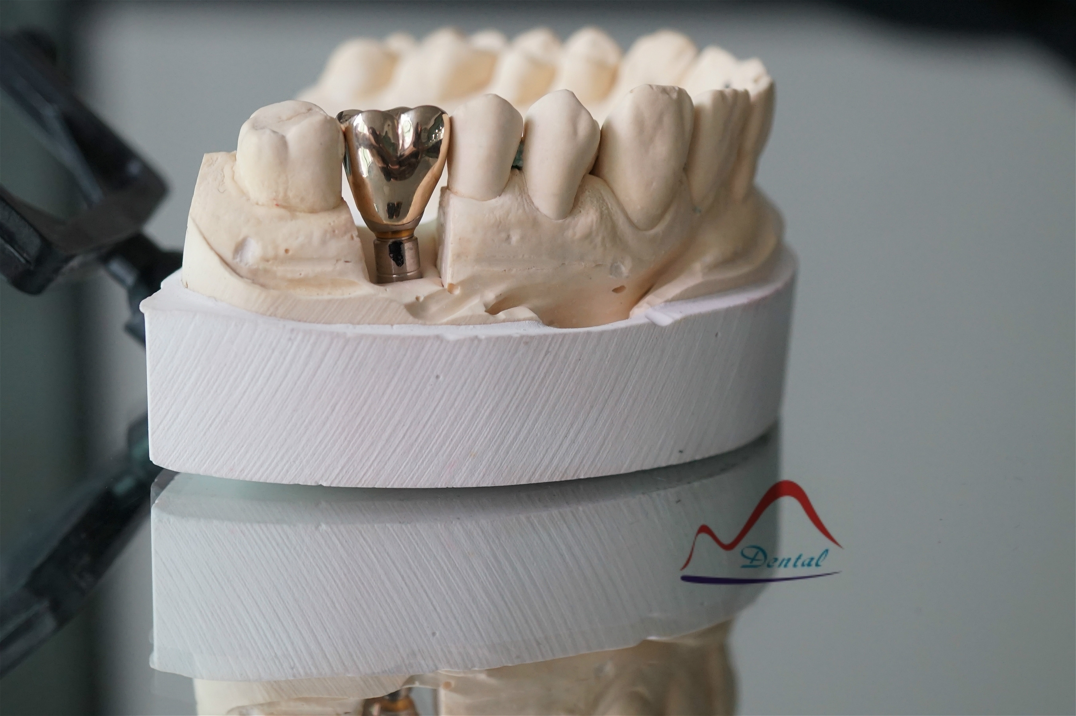 Implant full metal(3) Implant full metal(3)