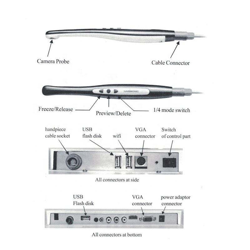 endoscope