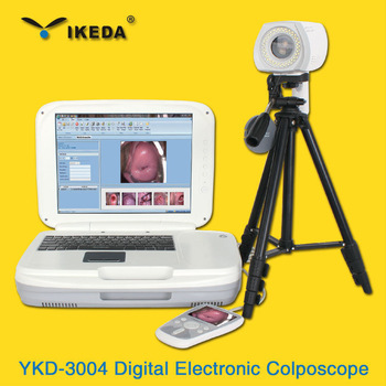 digital colposcope radiography system/gynaecology diagnostic equipment