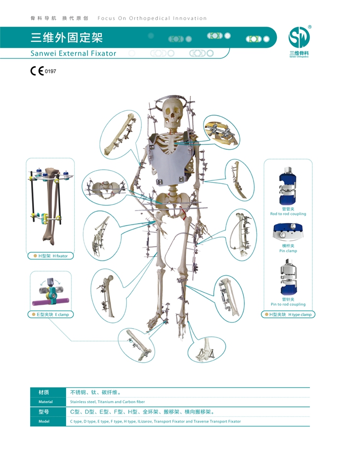 Sanwei External Fixator