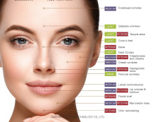 Privatel labeled hyaluronic acid dermal filler injection