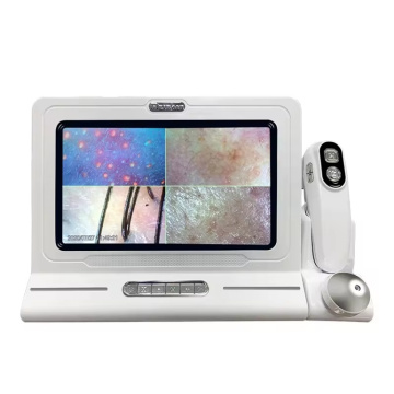 High Resolution 11 Inch Four-Spectrum Skin and Hair Scalp Analyzer