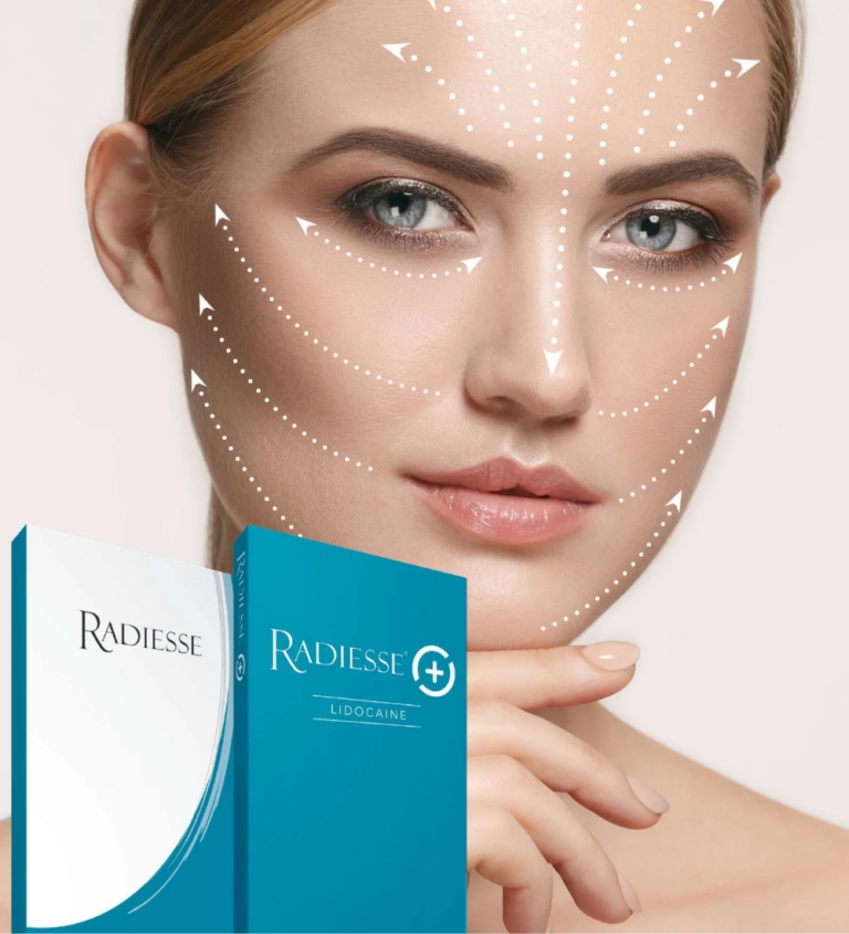 Radiesse 1.5cc Hydroxyapatite Collagen Remove Wrinkles