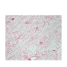 Higher Education Kidney Tissue Slides: Thick Section Physiology Injected Specimens