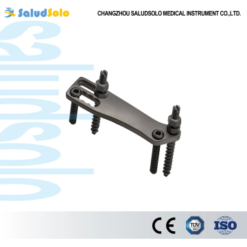 Anterior Thoracic Plate System