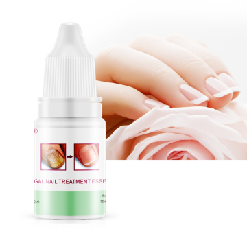 Balala Fungal Nail Treatment for Toe Nail Fungus