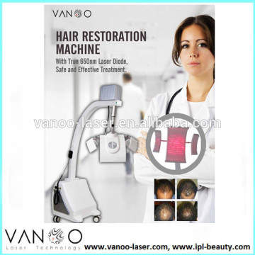 Hair Restoration laser