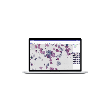 Assisted pathologische Diagnosesoftware