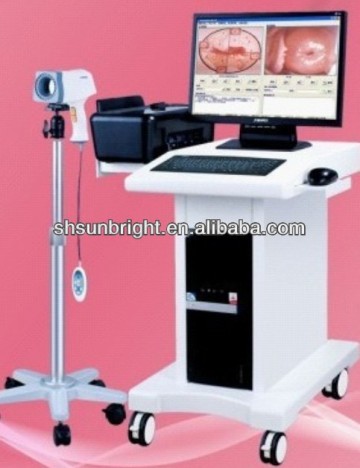 Gynecology Portable Digital Electronic Colposcope