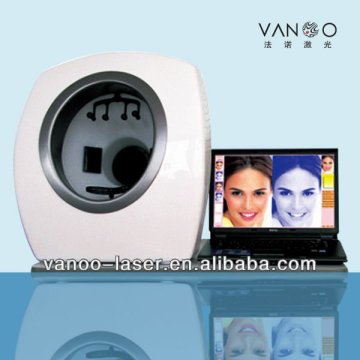 facial skin analysis machine