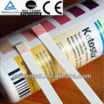 urinalysis