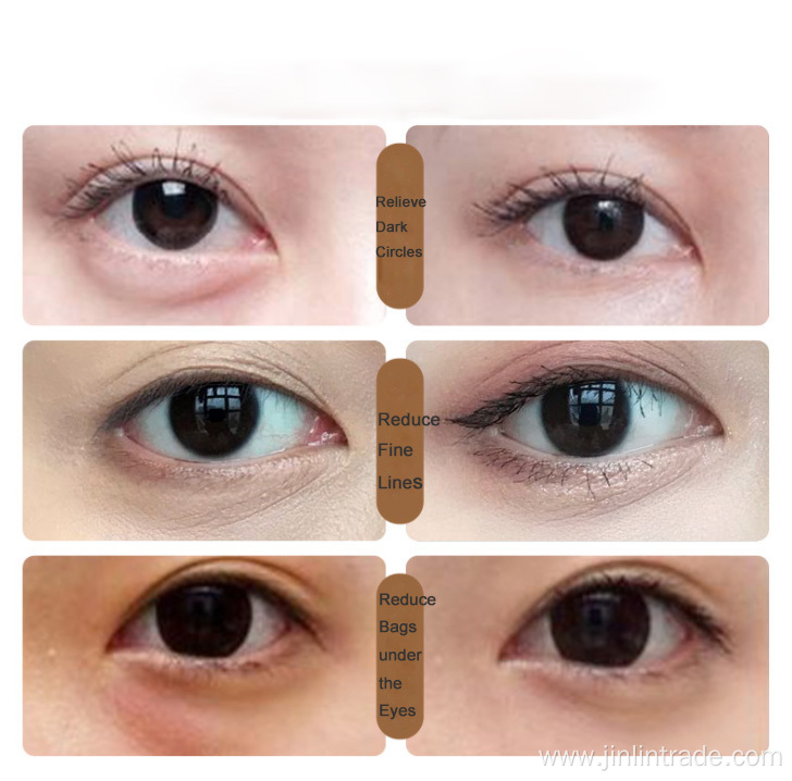 Eye Bag Removal Anti Dark Circle Eye Cream