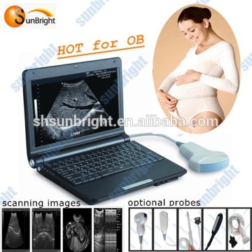 Baby OB ultrasound machine with OB report