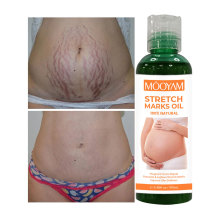 Stretch Mark Oil: Removing Stretch Marks & Pregnancy Mark Repair Oil
