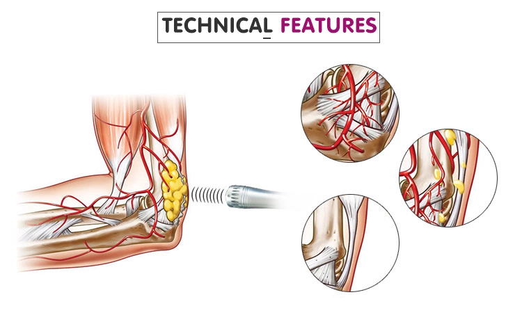 Physical Therapy Equipment Ultrasound physiotherapy Medical Physiotherapy Equipment