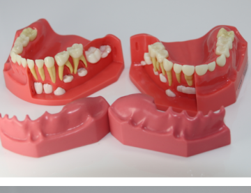 Pediatric Mixed Dentition Development Model Ages 5-9