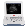 UW-580 Mesin Ultrasound Komputer Riba Penuh