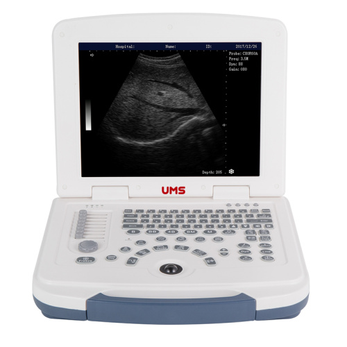 Mesin Ultrasound Laptop Full-Digital UW-580