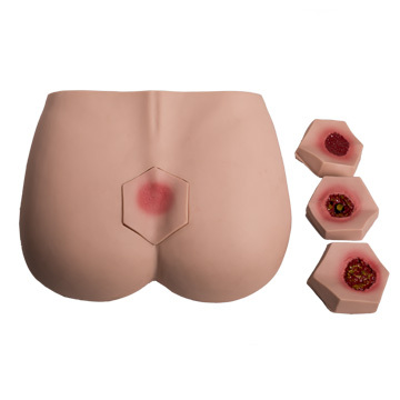 GD/H90F General Doctor Decubitus Ulcer Care Model