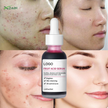 Private Label Fruit Acid Essence for Pore Shrinking and Skin Brightening