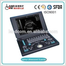 Portable Laptop ultrasound scanner with CE