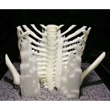 3D Printed Medical Devices