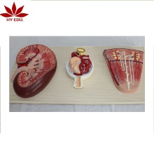 Direct Factory Medical Model Renal Nephron Renal Corpuscle Kidney Anatomical Model