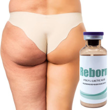 Butt Lift before and after