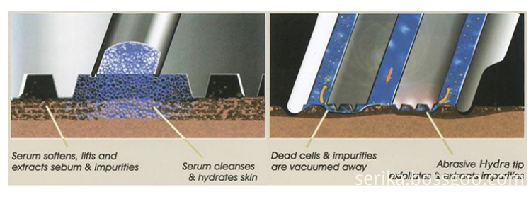 Diamond Dermabrasion Unit