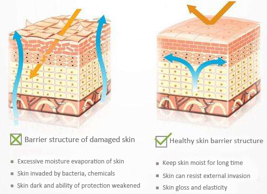 Skin barrier structure