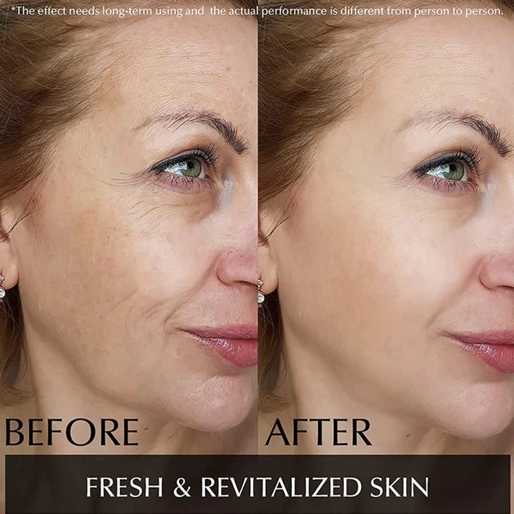 OEM Black Carbon Facial Treatment Mask Anti-Aging Anti-Wrinkles Peptide Collagen Sheet Masks