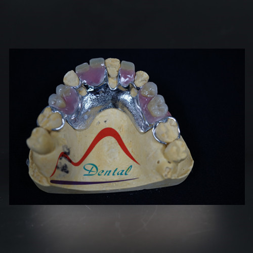 Fit CoCr Casting Partial Denture