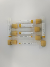 Vacuum Tube Gel Clot Activator Tube Glass Plastic