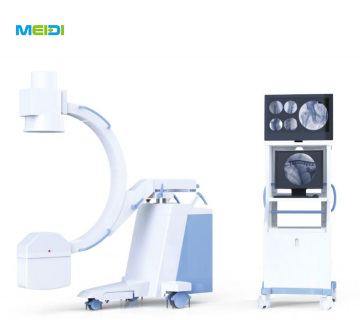 Mobile C Arm x ray machine for hospital