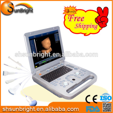 3D&4D USG/4D Laptop Ultrasound price 4D ultrasound machine