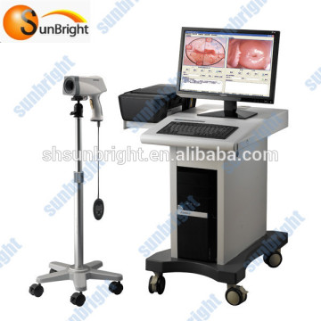 Medical colposcope system