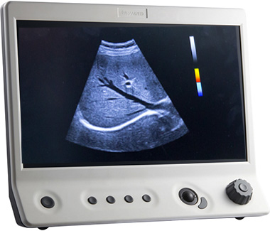 Color Ultrasound Machine