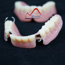 Acrylic Removable Partial Denture