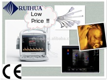 Portable Ultrasonic Diagnostic Devices Type echo sonogram