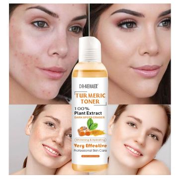 Turmeric Dark Spots Face Toner: Blemishes and Dark Spots Remover