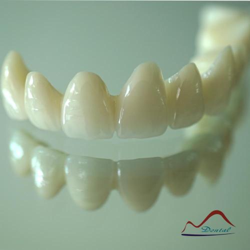 Long Full Contour 3Shape Zirconia Bridge