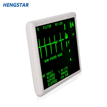 Monitor LCD Medis 17 &#39;&#39; dengan Layar Sentuh Resistif