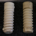 Railroad Nylon Lock Screw Dowel